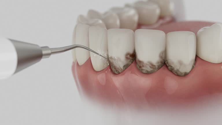 Trusted Invisalign Clear Aligners service in McChord AFB, WA - Dentist Open Now